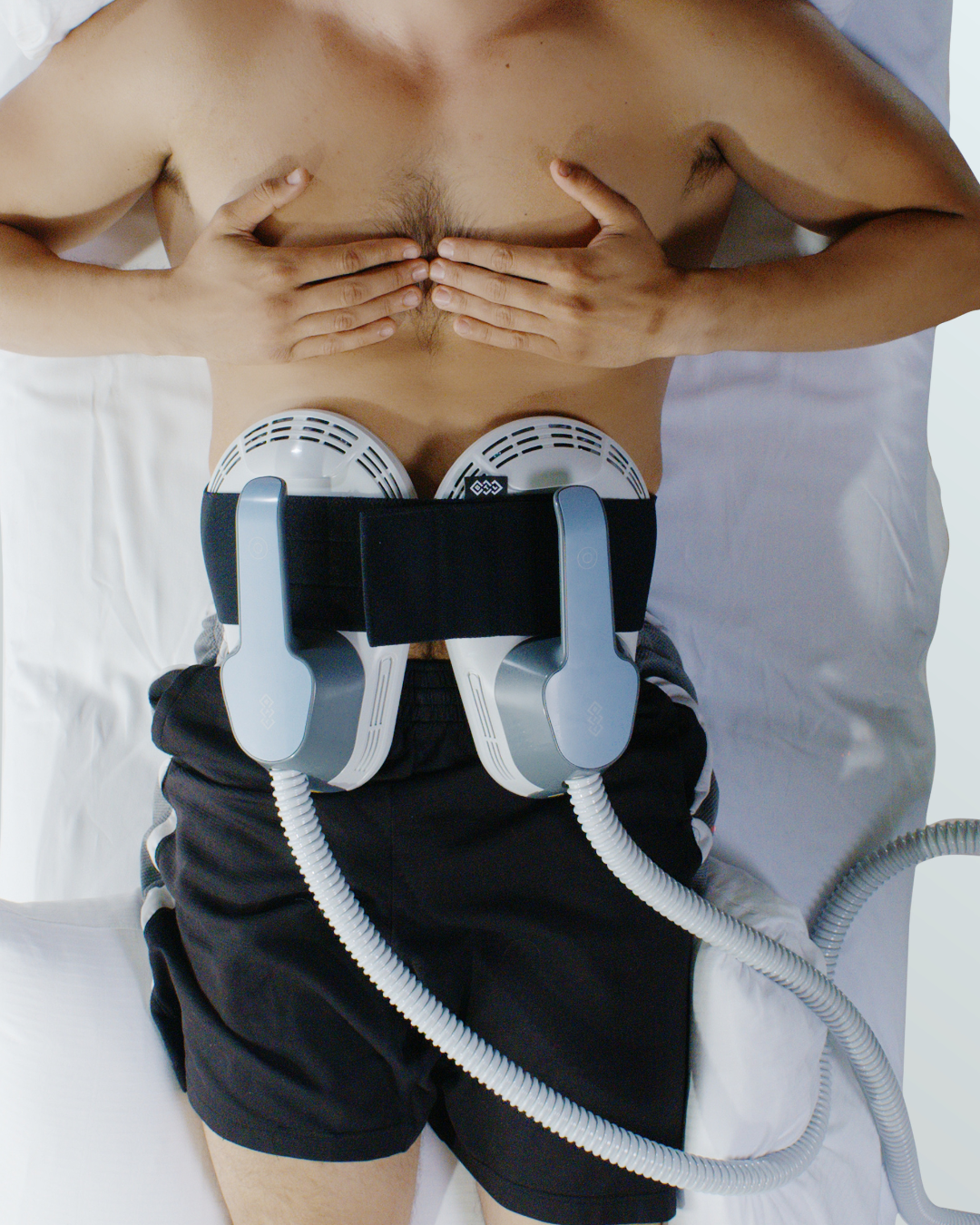 EmSculpt Body Sculpting 6 treatments