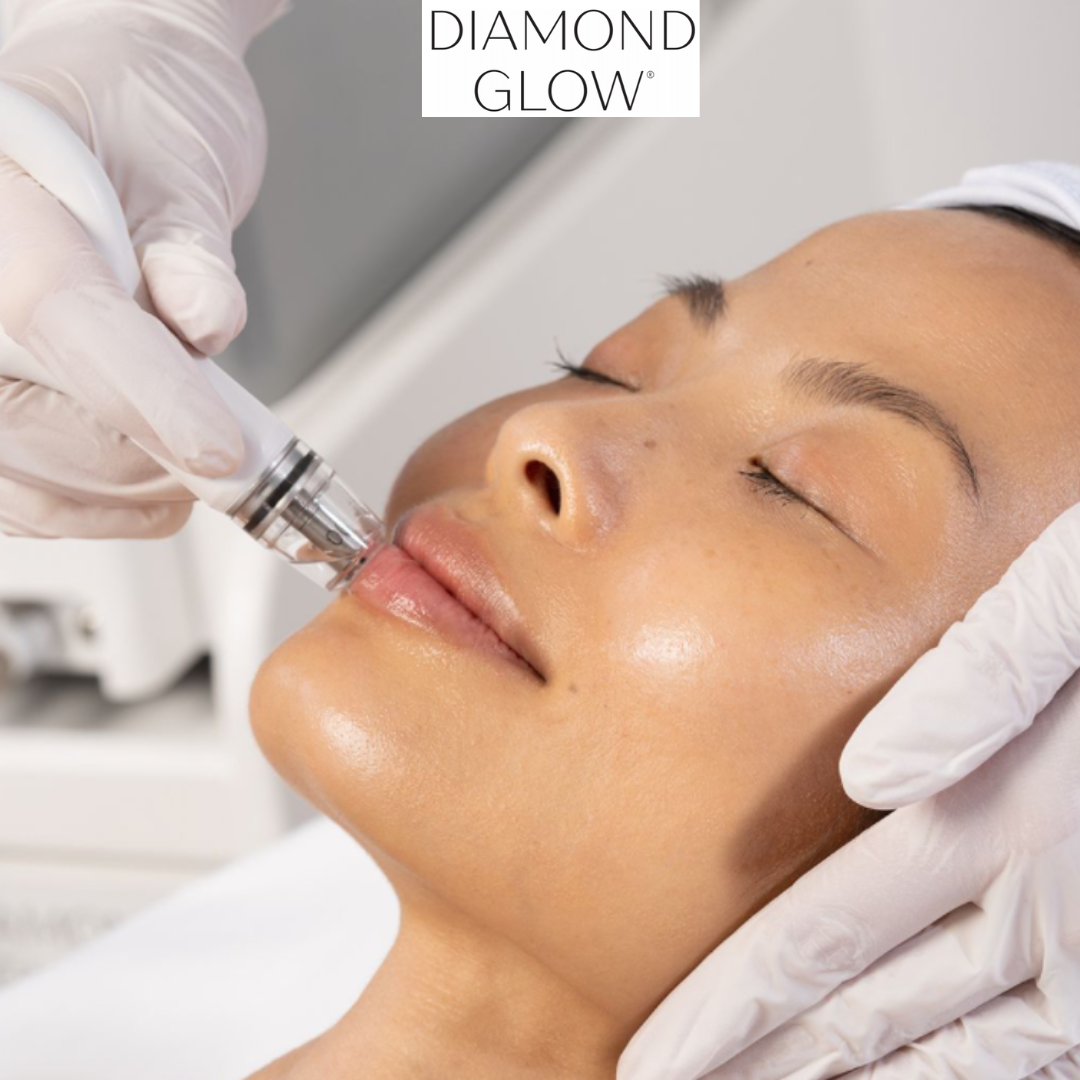 DiamondGlow 3 Treatment Package (Online Only)